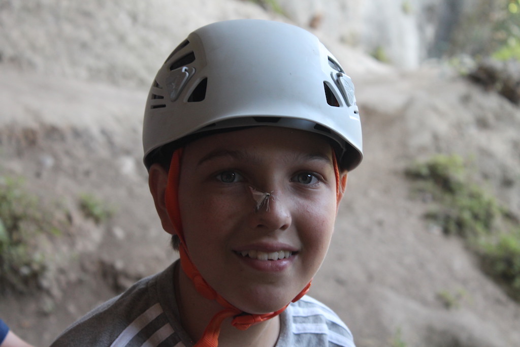 Village Camps International Summer Camp Ard&egrave;che, France 2019-07-26 https://www.villagecamps.com/journals_admin/images/2155-7892-MothNose.jpg